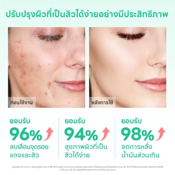 PAPA FEEL Salicylic Acid นักล่าสิว โลชั่นอบแห้ง 35ml-08