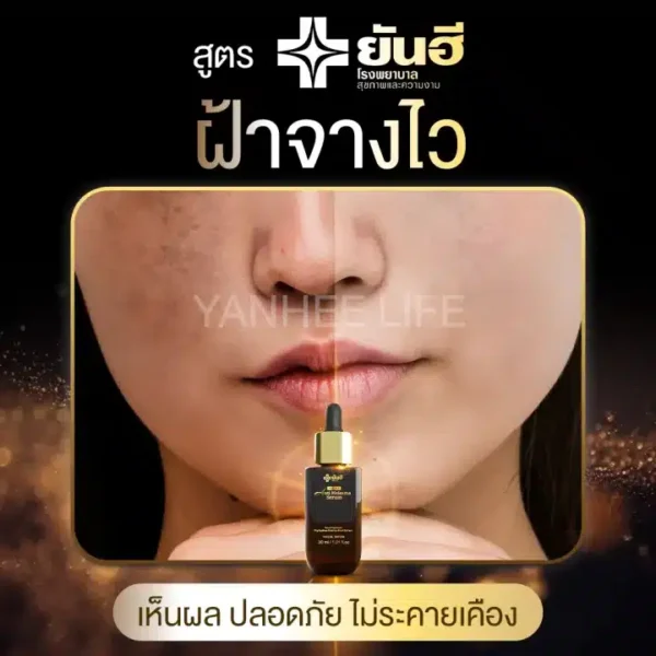 ยันฮี - 04