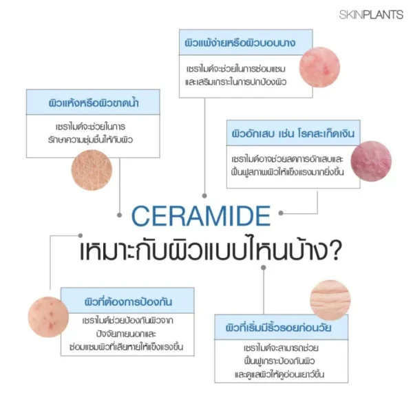 เซรั่ม - 05